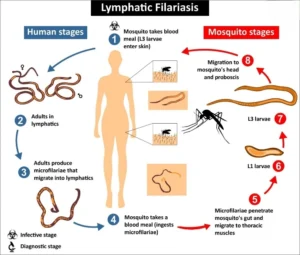 Lymphatic Filariasis