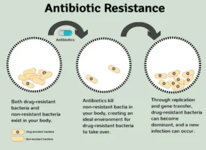 Antibiotic Resistance