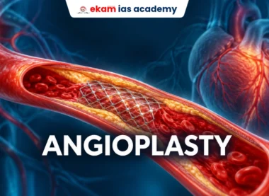 Angioplasty