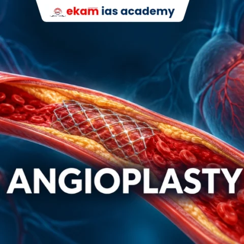 Angioplasty