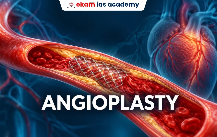 Angioplasty
